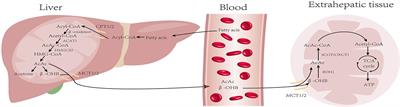 Ketogenic Diets and Hepatocellular Carcinoma